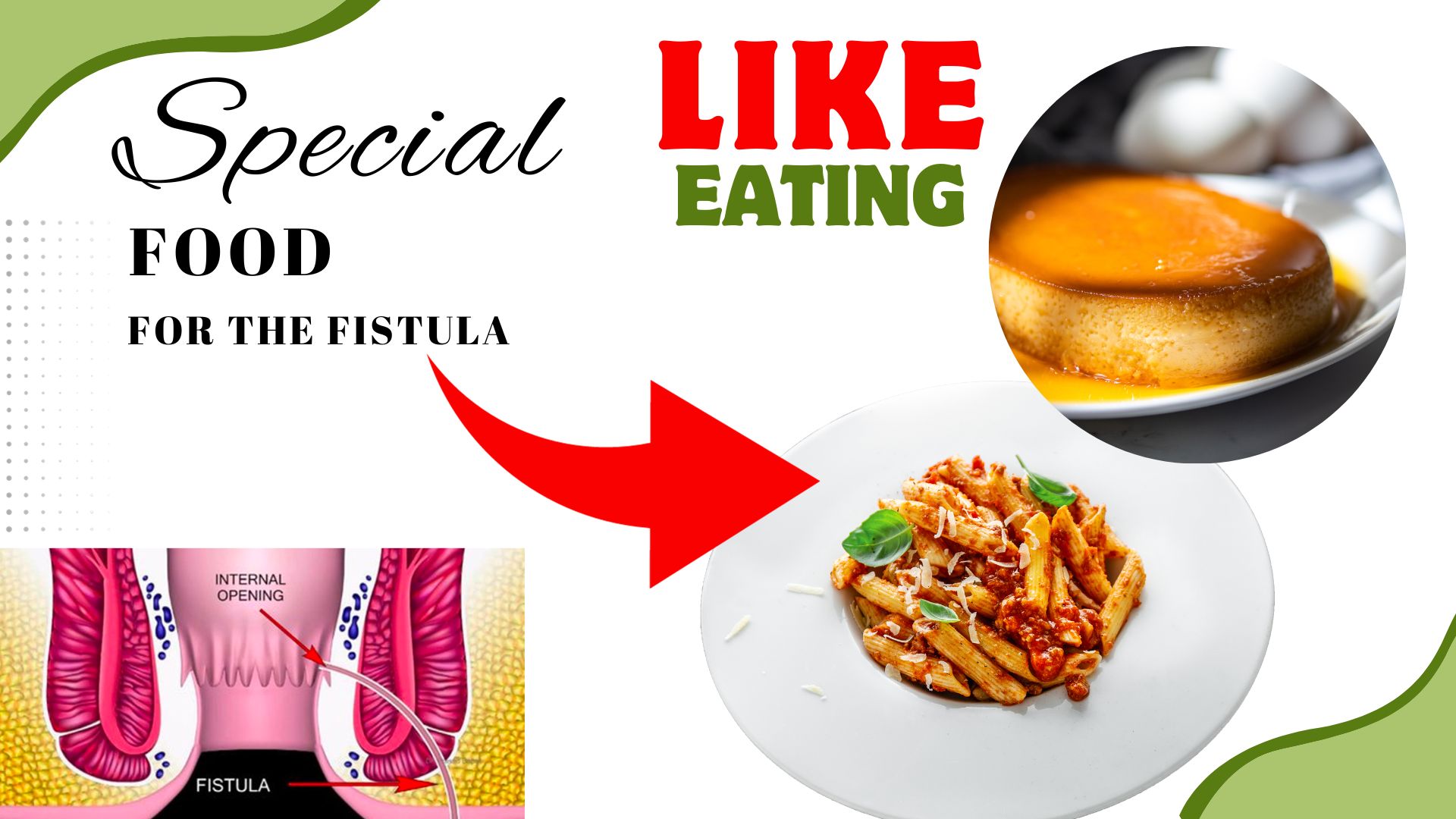 Fistula Causes