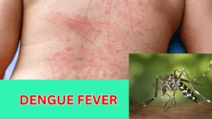 Dengue fever affects on the body and a mosquito