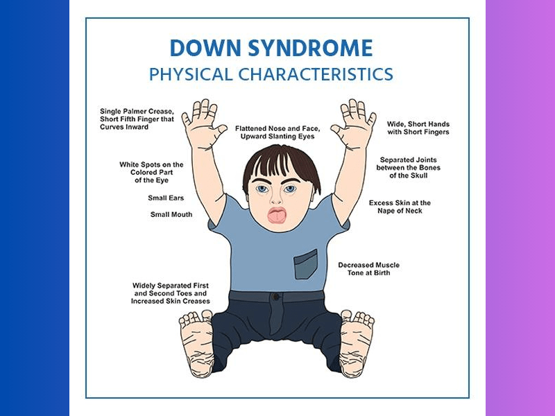 Genetic Disorders: 4 Common Genetic Disorders Genetic Disorders: 4 Common Genetic Disorders