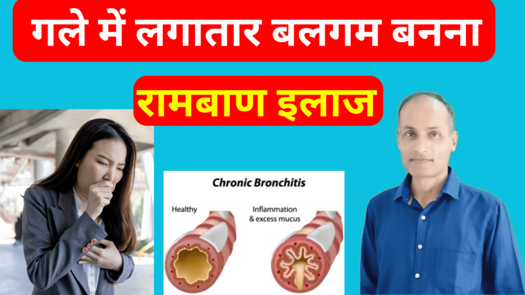 गले में कफ चिपकना, 8 कारण, लक्षण और इलाज: Gale Mein Kaf Chipakna Treat Easily Gale Mein Kaf Jamna | Phlegm In Throat in Hindi, गले में कफ चिपकना