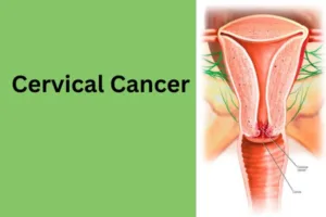 cervical cancer