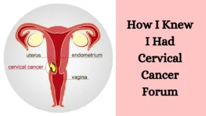 How I Knew I Had Cervical Cancer Forum