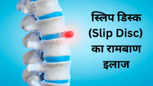 Slip Disc ka Ramban ilaj