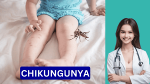 chikungunya rash images