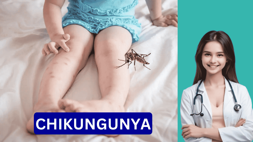 chikungunya rash images