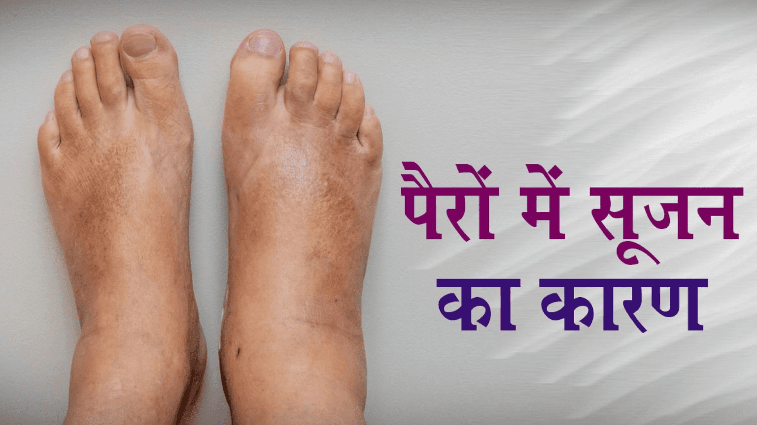 पैरों में सूजन और दर्द का इलाज